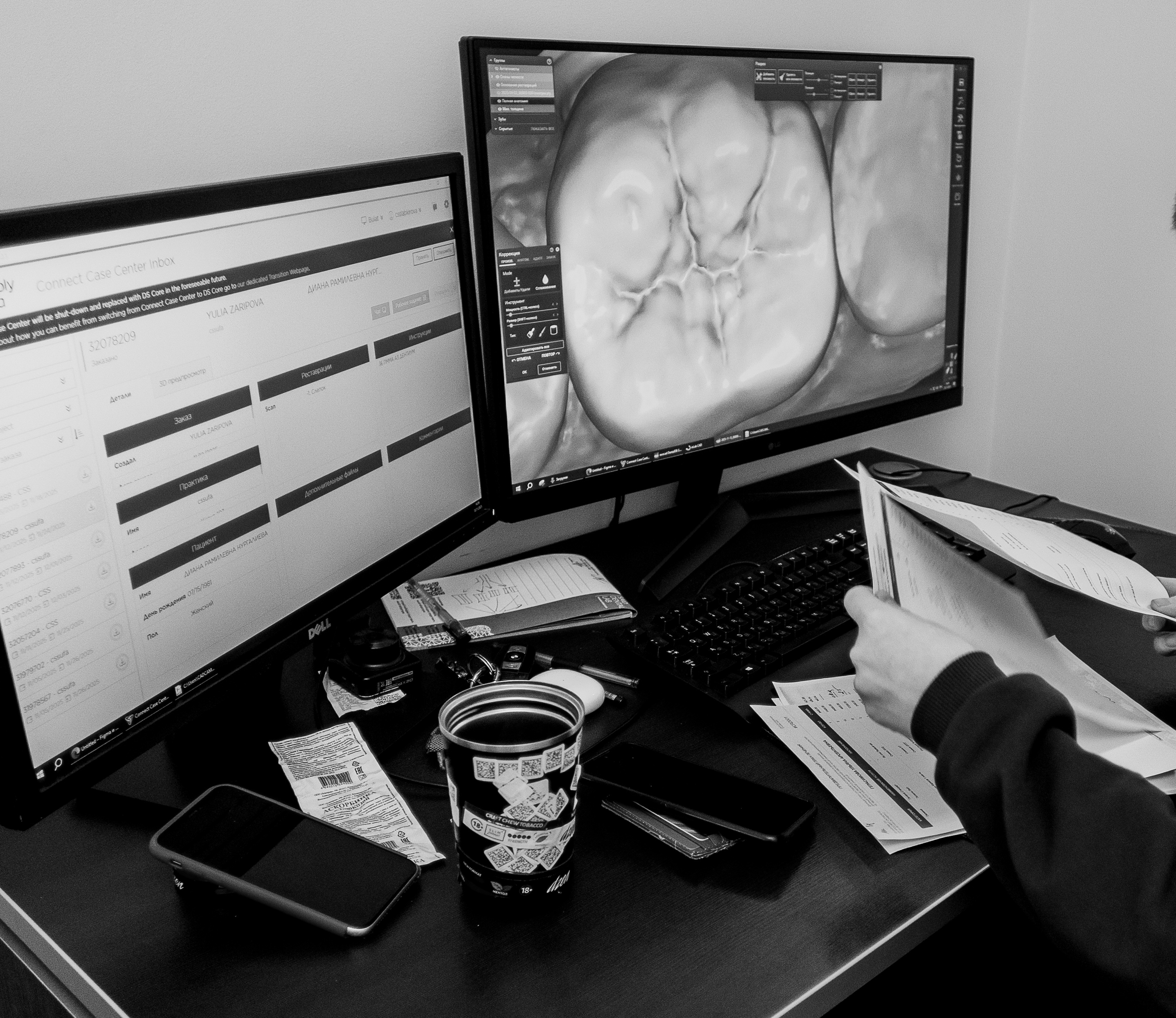 Digital dental workflow